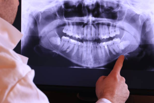 Best Emergency Dental Care for Sports Injuries in Bensville, MD